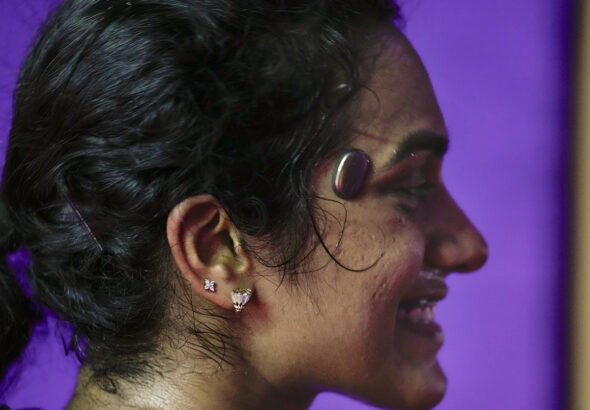 பி.வி. சிந்து பயன்படுத்திய Temple மூளை கண்காணிப்பு சாதனம் — Business Today பட ஆதாரம்