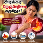 நெஞ்செரிச்சல் மற்றும் GERD
