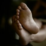 வறண்டு வெடித்த குதிங்கால் தோலின் நெருக்கமான காட்சி