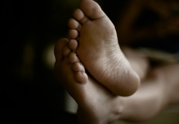 வறண்டு வெடித்த குதிங்கால் தோலின் நெருக்கமான காட்சி