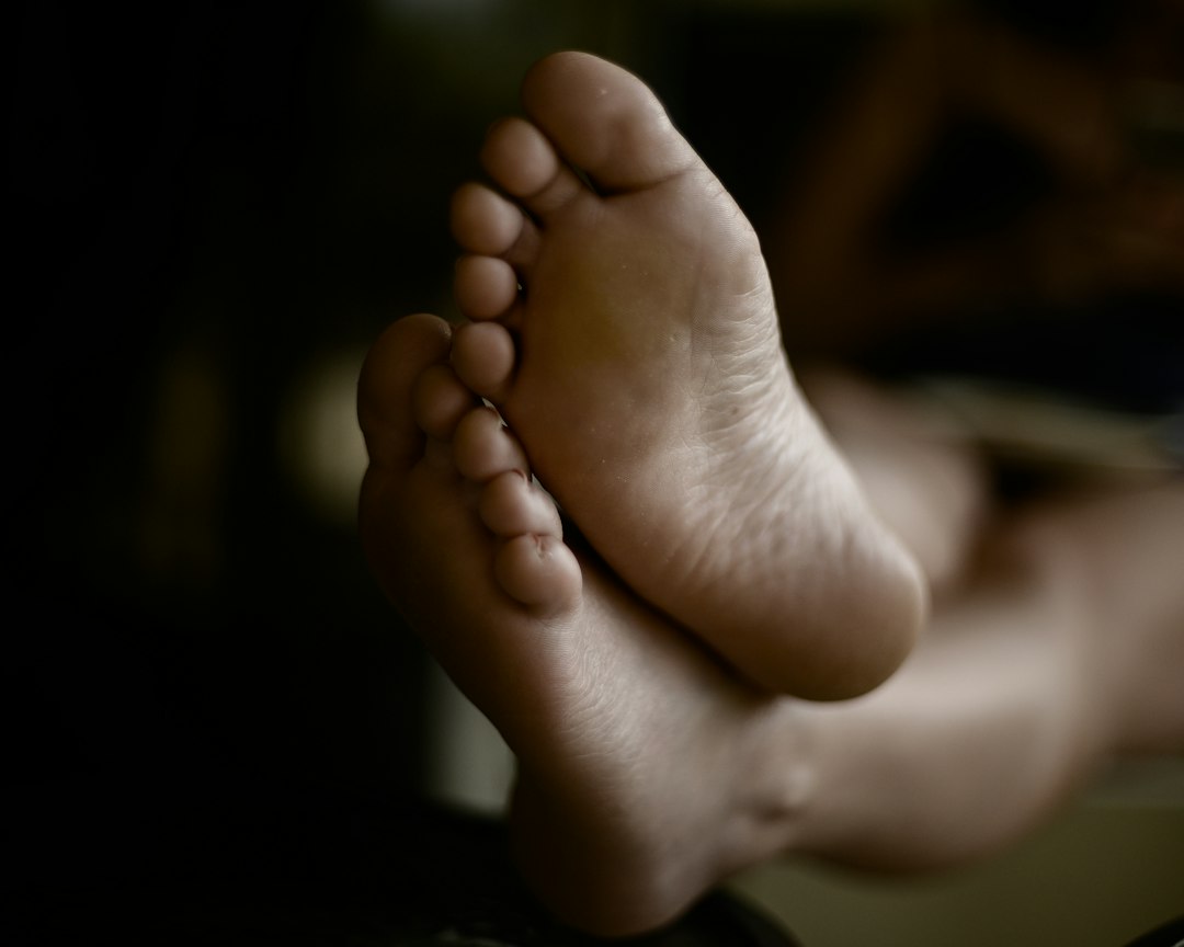 வறண்டு வெடித்த குதிங்கால் தோலின் நெருக்கமான காட்சி